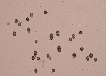 Calicium glaucellum Spores Povydri 2020